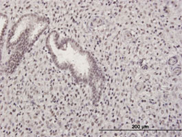 ab88746 at 3 µg/ml staining GABPB2 in formalin-fixed, paraffin-embedded Human endometrium by immunohistochemistry.