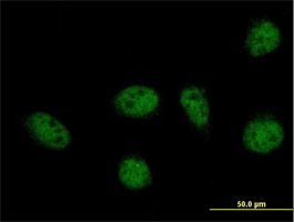 ab88746 at 10 µg/ml staining GABPB2 in PFA-fixed, permeabilised HeLa cells by immunofluorescence.