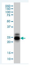 Anti-CREG1 antibody (ab68341) at 5 µg/ml + HL60 cell lysate at 25 µgSecondaryGoat Anti-Mouse IgG (H&L)-HRP Conjugate at 1/2500 dilution