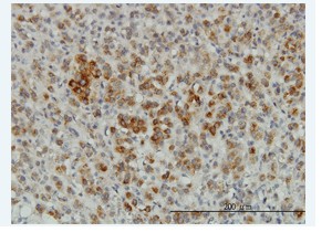 ab68341 staining CREG1 on formalin-fixed paraffin-embedded human adrenal gland tissue. Antibody concentration 3 ug/ml. Antigen retrieval in 1X citrate buffer (pH 6.0) and microwave at 750W for 20 minutes was performed.