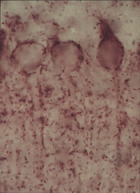 Mouse monoclonal [GAD-6] to GAD65 staining GAD65-containing nerve terminals around cell bodies of Purkinje cells in the rat cerebellar cortex.