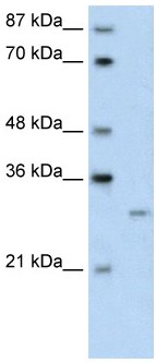 Anti-CREG1 antibody (ab59719) at 0.5 µg/ml + 293T cell lysate at 10 µg with 5% skim milk / PBS bufferSecondaryHRP conjugated anti-Rabbit IgG at 1: 50,000 - 100,000