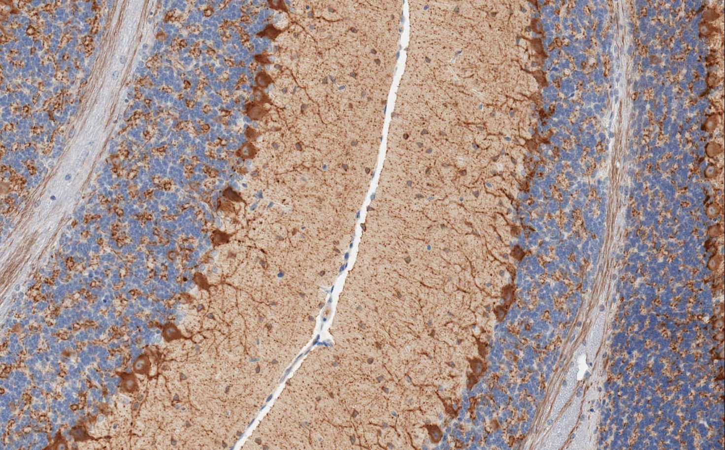 ab26116, at a 1/2000 dilution, staining of fixed mouse cerebellum sections that underwent an antigen retrieval step. 
