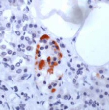 Ab37403 staining GAD67 in human pancreas using immunohistochemistry with formalin fixed, paraffin embedded tissue.