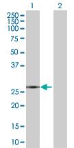 All lanes : Anti-GAGE1 antibody (ab67412) at 1/500 dilutionLane 1 : GAGE1 transfected 293T lysateLane 2 : Non transfected 293T lysateLysates/proteins at 25 µg per lane.SecondaryGoat Anti-Mouse IgG (H&L)-HRP Conjugate at 1/2500 dilution