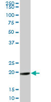 Anti-GAJ antibody (ab67124) at 1/500 dilution + human H1 skeletal muscle tissue lysate at 25 µg/mlSecondaryGoat Anti-Mouse IgG (H&L)-HRP Conjugate at 1/2500 dilution