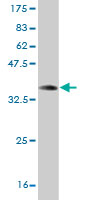 Western blot against tagged recombinant protein immunogen using ab58274 Galanin antibody at 1ug/ml.