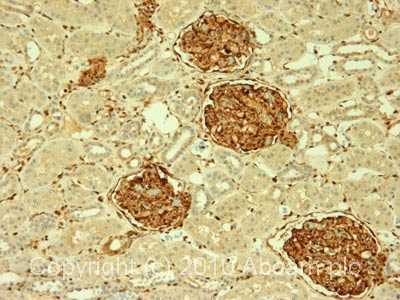 IHC image of ab25138 staining in human normal kidney formalin fixed paraffin embedded tissue section, performed on a Leica BondTM system using the standard protocol F. The section was pre-treated using heat mediated antigen retrieval with sodium citrate buffer (pH6, epitope retrieval solution 1) for 20 mins. The section was then incubated with ab25138, 1µg/ml, for 15 mins at room temperature and detected using an HRP conjugated compact polymer system. DAB was used as the chromogen. The section was then counterstained with haematoxylin and mounted with DPX.For other IHC staining systems (automated and non-automated) customers should optimize variable parameters such as antigen retrieval conditions, primary antibody concentration and antibody incubation times.