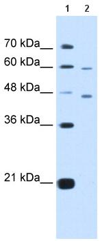 All lanes : Anti-CRELD1 antibody (ab65557) at 5 µg/mlLane 1 : MW markerLane 2 : HepG2 cell lysate at 10 µgSecondaryLane 2 : HRP conjugated anti-Rabbit IgG at 50000 