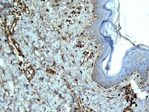 Immunohistochemical analysis of paraffin embedded Human skin tissue labelling Galectin 1 with ab138513 antibody at a dilution of 1/250.