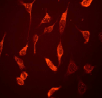 ab76466, at a 1/100 dilution, staining Galectin 3 in HeLa cells by Immunofluorescence.