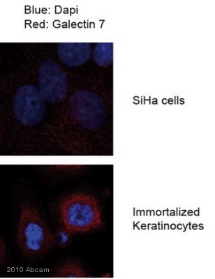 ab10482 staining Galectin7 in Human cervical tumor and immortalized keratinocytes by ICC/IF (Immunocytochemistry/immunofluorescence). Cells were fixed with paraformaldehyde, permeabilized with 0.25% Triton X-100/PBS and blocked with 1% BSA for 1 hourat 25°C. Samples were incubated with primary antibody (1/1000 in 1% BSA/PBS) for 24 hours at 4°C. An Alexa Fluor®594-conjugated Goat anti-rabbit IgG polyclonal (1/2000) was used as the secondary antibody. SiHa cells (negative control - very low Gal-7 mRNA) Immortilized keratinocytes (positive control - high Gal-7 mRNA)