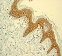ab108623, at 1/500 dilution, staining Galectin 7 in paraffin-embedded Human skin tissue by Immunohistochemistry.