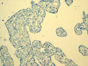 ab108623 showing negative staining in Normal liver tissue.