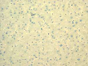 ab108623 showing negative staining in Normal liver tissue.
