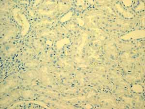 ab108623 showing negative staining in Normal kidney tissue.