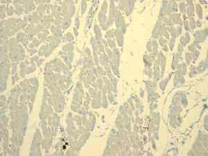 ab108623 showing negative staining in Normal heart tissue.