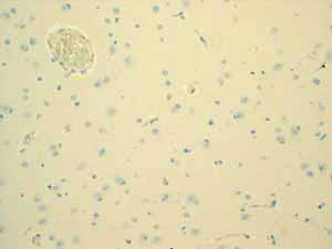 ab108623 showing negative staining in Normal brain tissue.