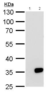 All lanes : Anti-Galectin 8 antibody (ab183637) at 1/5000 dilutionLane 1 : 293T whole cell lysateLane 2 : Whole cell lysate of Human Galectin 8 transfected 293T cellsLysates/proteins at 30 µg per lane.