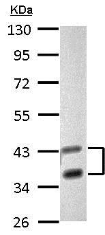Anti-Galectin 8 antibody (ab183637) at 1/1000 dilution + HepG2 whole cell lysate at 30 µg