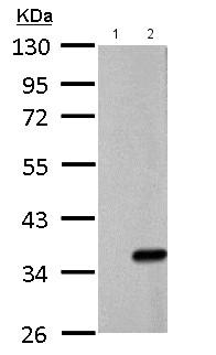 All lanes : Anti-Galectin 8 antibody (ab183637) at 1/5000 dilutionLane 1 : 293T whole cell lysateLane 2 : Galectin 8 transfected 293T whole cell lysateLysates/proteins at 30 µg per lane.