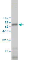 Western blot against tagged recombinant protein immunogen using ab58088 galectin 8 antibody at 1ug/ml.