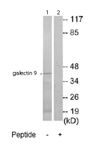 All lanes : Anti-galectin 9 antibody (ab69630) at 1/500 dilutionLane 1 : Extracts from HepG2 cellsLane 2 : Extracts from HepG2 cells with immunising peptide at 5 µgLysates/proteins at 5 µg per lane.