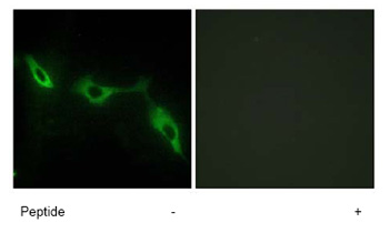 Immunofluorescence analysis of NIH/3T3 cells using ab69630 at 1/500 dilution, with (right panel) or without (left panel) the immunising peptide.