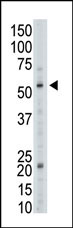 Anti-GALK2 antibody (ab38179) at 1/100 dilution + HL60 cell lysate