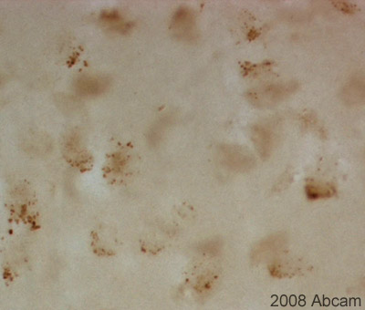 ab59023 (1/100) staining CRF1 in paraffin embedded mouse brain tissue sections. Tissues were fixed in paraformaldehyde and permeabilised with 0.3% Triton X100/TBS. Please refer to abreview for further experimental details.See Abreview