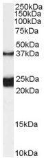 Anti-GALR1 antibody (ab59027) at 0.1 µg/ml + Rat Spinal Cord lysate (35µg protein in RIPA buffer).