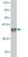 Western blot against tagged recombinant protein immunogen using ab57327 CRIM1 antibody at 1ug/ml.