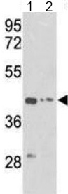 All lanes : Anti-gamma Actin antibody (ab194952) at 1/1000 dilutionLane 1 : K562 cell line lysateLane 2 : HepG2 cell line lysateLysates/proteins at 35 µg per lane.