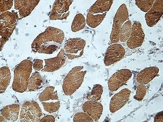 Immunohistochemistry (Formalin/PFA-fixed paraffin-embedded sections) analysis of human fetal muscle tissue labelling gamma Actin with ab84479 at a dilution of 1/100.