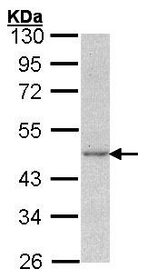 Anti-gamma Actin antibody (ab97379) at 1/1000 dilution + A431 whole cell lysate at 30 µg