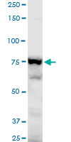 Anti-gamma Adducin antibody (ab194426) at 1/500 dilution + mouse NIH 3T3 cell lysate at 50 µgdeveloped using the ECL technique