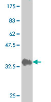 Western blot against tagged recombinant protein immunogen using ab54665 gamma C Crystallin antibody at 1ug/ml.
