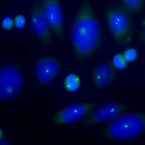 Ab11317 staining cultured hamster cells (CHO cells) by ICC. The cells were fixed with paraformaldehyde and incubated with ab11317 at a dilution of 1/5000 for 12 hours. A polyclonal goat anti-rabbit antibody conjugated to Alexa Fluor ® 488 was used as the seconday antibody. This image is courtesy of an Abreview submitted by Dr Jan Postberg on 7 December 2005.See Abreview