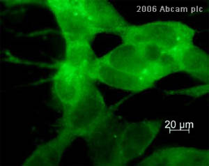 ab11320 at 1/400 dilution staining human neuroblastoma cells by ICC/IF. The cells were fixed with paraformaldehyde and blocked with serum and then incubated with the primary antibody for 16 hours. ab6717, a Goat polyclonal to Rabbit IgG H&L (FITC), was used as the secondary.See Abreview