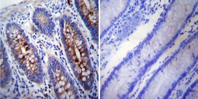 Immunohistochemical analysis of Human colon tissue, labeling gamma Tubulin with ab173831 at a 1/200 dilution (left panel) or without primary antibody (right panel). To expose target proteins, heat induced antigen retrieval was performed using 10mM sodium citrate (pH6.0) buffer, microwaved for 8-15 minutes. Detection was performed using a biotin-conjugated secondary antibody and SA-HRP, followed by colorimetric detection using DAB. Tissues were counterstained with hematoxylin and prepped for mounting.
