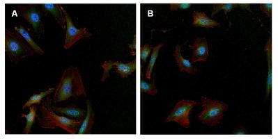 Immunofluorescence analysis of formalin-fixed, permeabilized A) HeLa cells and B) U2OS, labeling gamma Tubulin (green) using ab173831 at a 1/50 dilution. Cells were washed with PBS and incubated with a DyLight-488 conjugated secondary antibody. F-Actin (red) was stained with DyLight 547 Phalloidin and nuclei (blue) were stained with Hoechst 33342 dye.