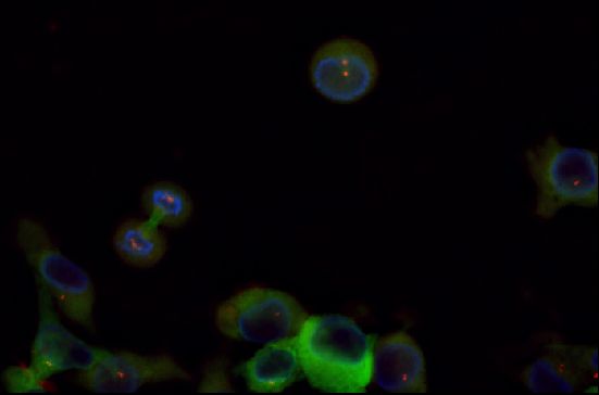 ab27074 staining gamma tubulin (red) in rat prostate carcinoma cells by ICC/IF. The cells were also transfected with beta-tubulin GFP which stained green.