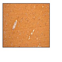 Immunohistochemical analysis of GAP43 in paraffin-embedded human brain tissue using ab75810 at 1/500 dilution.
