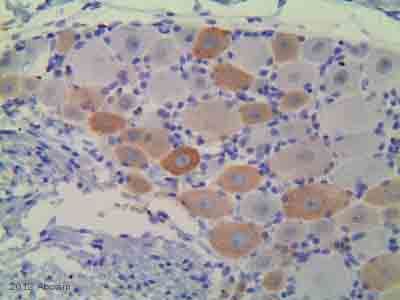 ab75810 staining GAP43 in rat DRG by Immunohistochemistry (Formalin/PFA-fixed paraffin-embedded sections).Tissue was fixed in paraformaldehyde and a heat mediated antigen retrieval step was performed using sodium citrate pH 6.0. Samples were then blocked using 5% serum for 10 minutes at 37°C and incubated with ab75810 at a 1/200 dilution for 1 hour at 37°C. The secondary used was bioitin conjugated goat anti-rabbit IgG used at a 1/200 dilution.See Abreview