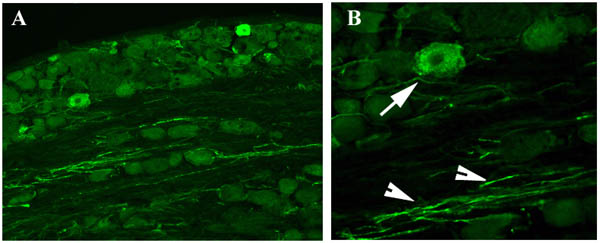 Immunofluorescent staining obtained with ab16053 Rabbit polyclonal to GAP43 in rat dorsal root ganglion, 2 weeks after a spinal nerve injury. The staining is localised in the cytoplasm of some lesioned neurons (arrow in B) and in many axons (arrow heads in B). Image B (X40 objective) is a higher magnification of A (X20). The staining disappeared completely when the antibody was pre-incubated with the immunising (blocking) peptide (ab16379). Protocol details: Rats were intracardially perfused with 4% paraformaldehyde, DRG tissue was post-fixed overnight in the same fixative, cryoprotected in 20% sucrose and frozen in OCT. IHC free floating was performed on the fixed, frozen and cut (20µm sections) rat tissue. Primary antibody ab16053 was incubated overnight at toom temperature at 1/300. Secondary antibody Alexa fluor 488 was incubated at 1/1000 for 2 hours at room temperature.