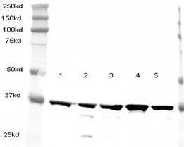 All lanes : Anti-GAPDH antibody [6C5] (ab8245) at 2.5 µg/mlLane 1 : HeLa NuclearLane 2 : HeLa whole cell lysateLane 3 : A431 cell lysateLane 4 : Jurkat cell lysateLane 5 : HEK293 cell lysateLysates/proteins at 20 µg per lane.SecondaryAlexa Fluor anti-mouse at 1/5000 dilutionPerformed under reducing conditions.