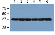 All lanes : Anti-GAPDH antibody [GA1R] (ab125247) at 1/2000 dilutionLane 1 : Human tissue lysateLane 2 : Mouse tissue lysateLane 3 : Rat tissue lysateLane 4 : Rabbit tissue lysateLane 5 : Chicken tissue lysateLane 6 : Hamster tissue lysateLysates/proteins at 5 µg per lane.developed using the ECL technique