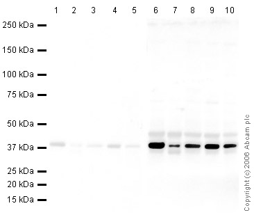 Lanes 1 - 5 :  Anti-GAPDH antibody [mAbcam 9484] - Loading Control (ab9484) at 1/1000 dilution (Blocked in 5% MILK)Lanes 6 - 10 :  Anti-GAPDH antibody [mAbcam 9484] - Loading Control (ab9484) at 1/1000 dilution (Blocked in 5% BSA)Lane 1 : HeLa (Human epithelial carcinoma cell line) Nuclear LysateLane 2 : HeLa (Human epithelial carcinoma cell line) Whole Cell LysateLane 3 : A431 (Human epithelial carcinoma cell line) Whole Cell Lysate (ab7909)Lane 4 : Jurkat (Human T cell lymphoblast-like cell line) Whole Cell Lysate (ab7899)Lane 5 : HEK293 (Human embryonic kidney cell line) Whole Cell Lysate (ab7902)Lane 6 : HeLa (Human epithelial carcinoma cell line) Nuclear LysateLane 7 : HeLa (Human epithelial carcinoma cell line) Whole Cell LysateLane 8 : A431 (Human epithelial carcinoma cell line) Whole Cell Lysate (ab7909)Lane 9 : Jurkat (Human T cell lymphoblast-like cell line) Whole Cell Lysate (ab7899)Lane 10 : HEK293 (Human embryonic kidney cell line) Whole Cell Lysate (ab7902)Lysates/protein