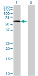 All lanes : Anti-CRISPLD1 antibody (ab69523) at 1/500 dilutionLane 1 : CRISPLD1 transfected 293T cell lysateLane 2 : Non-transfected 293T cell lysateLysates/proteins at 25 µg per lane.SecondaryGoat anti-mouse IgG (H&L)-HRP conjugate at 1/2500 dilution