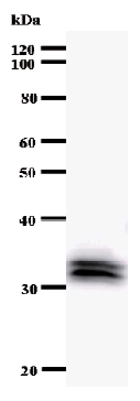 Anti-GAS41 antibody [YEATB1A8] (ab50963) + Immunized recombinant YEATS4